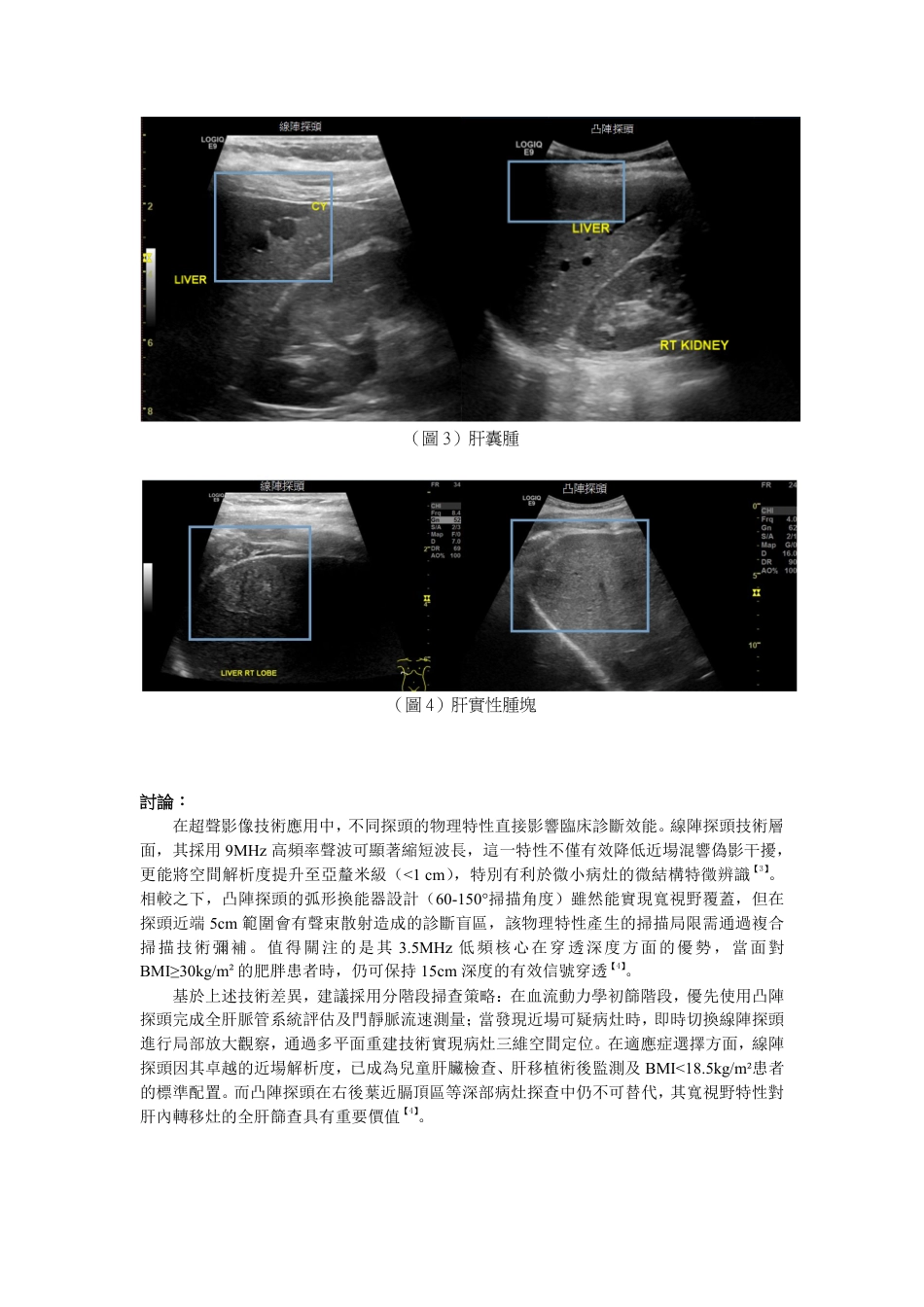 25年医学影像技术 超声线阵探头与凸阵探头在肝脏近场病变中的应用比较终-3102.pdf_第4页