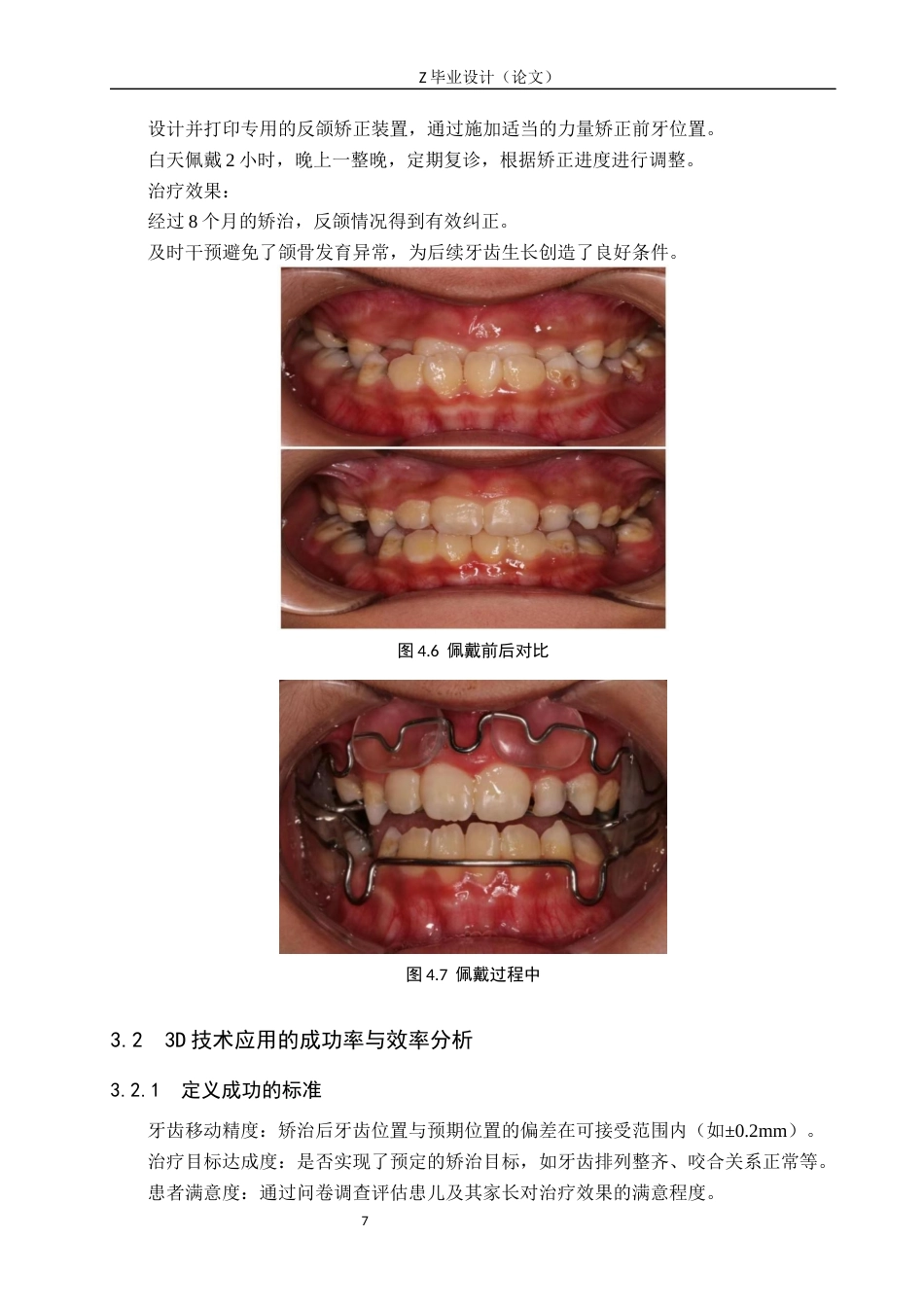 25年WP口腔医学技术-3D打印在儿童早期干预中的应用与发展-查重15.96AI62.270-9212.docx_第10页