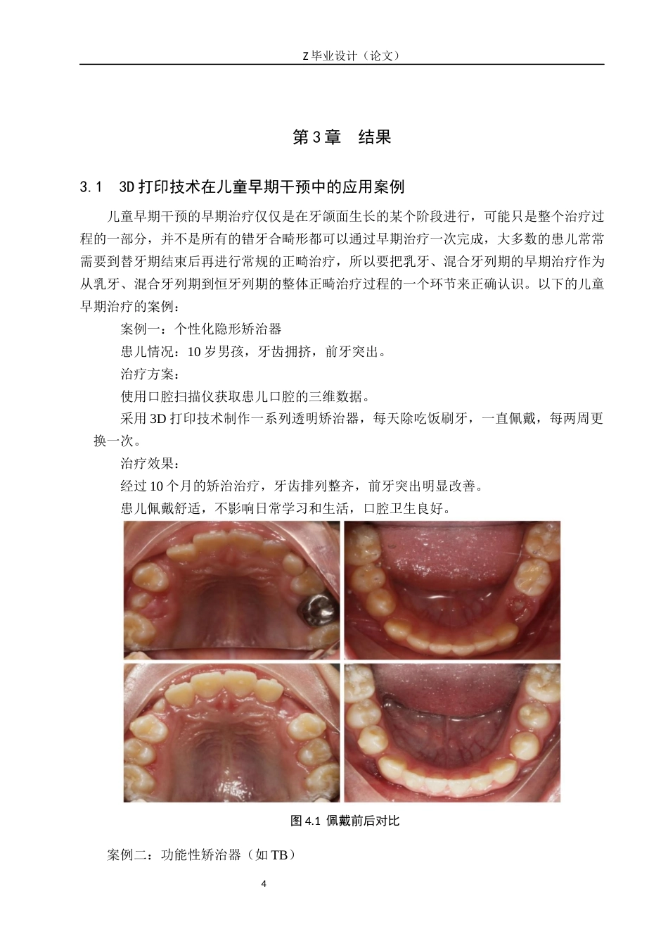 25年WP口腔医学技术-3D打印在儿童早期干预中的应用与发展-查重15.96AI62.270-9212.docx_第7页