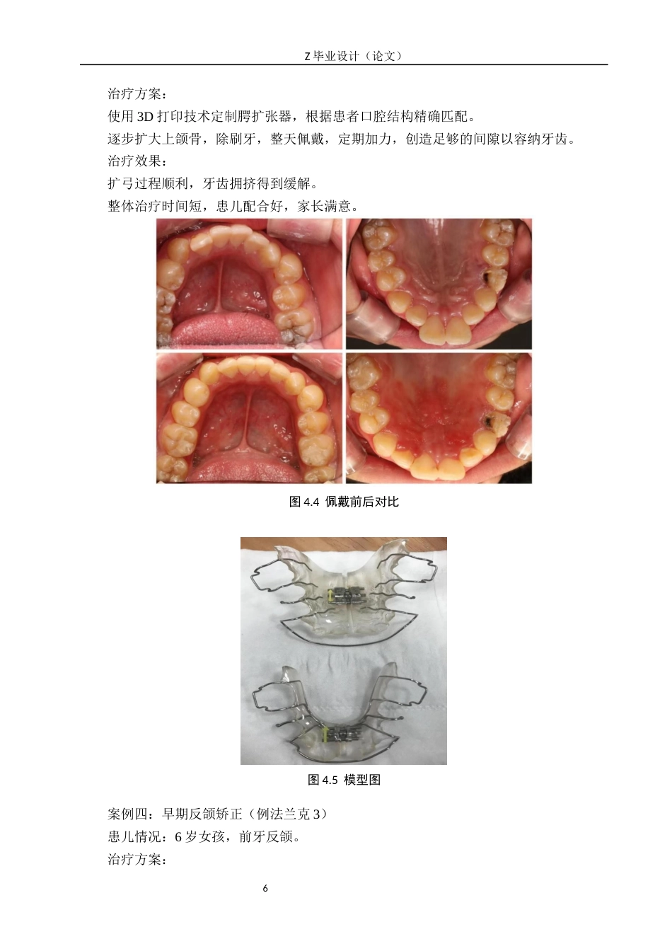 25年WP口腔医学技术-3D打印在儿童早期干预中的应用与发展-查重15.96AI62.270-9212.docx_第9页