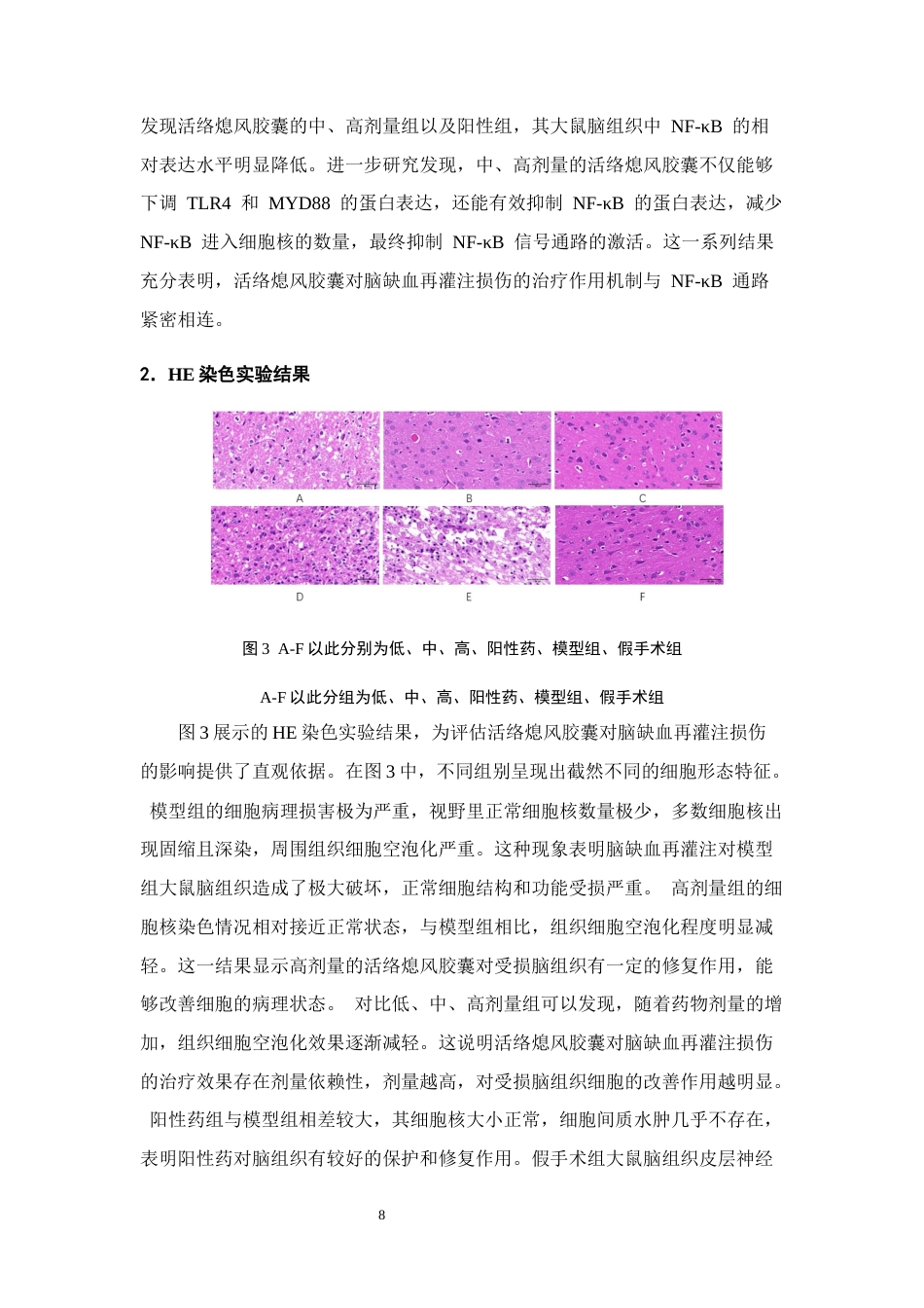 25年CH制药工程-基于NF-κB通路研究活络熄风胶囊治疗脑缺血再灌注的作用机制-约7397字符终稿.docx_第10页