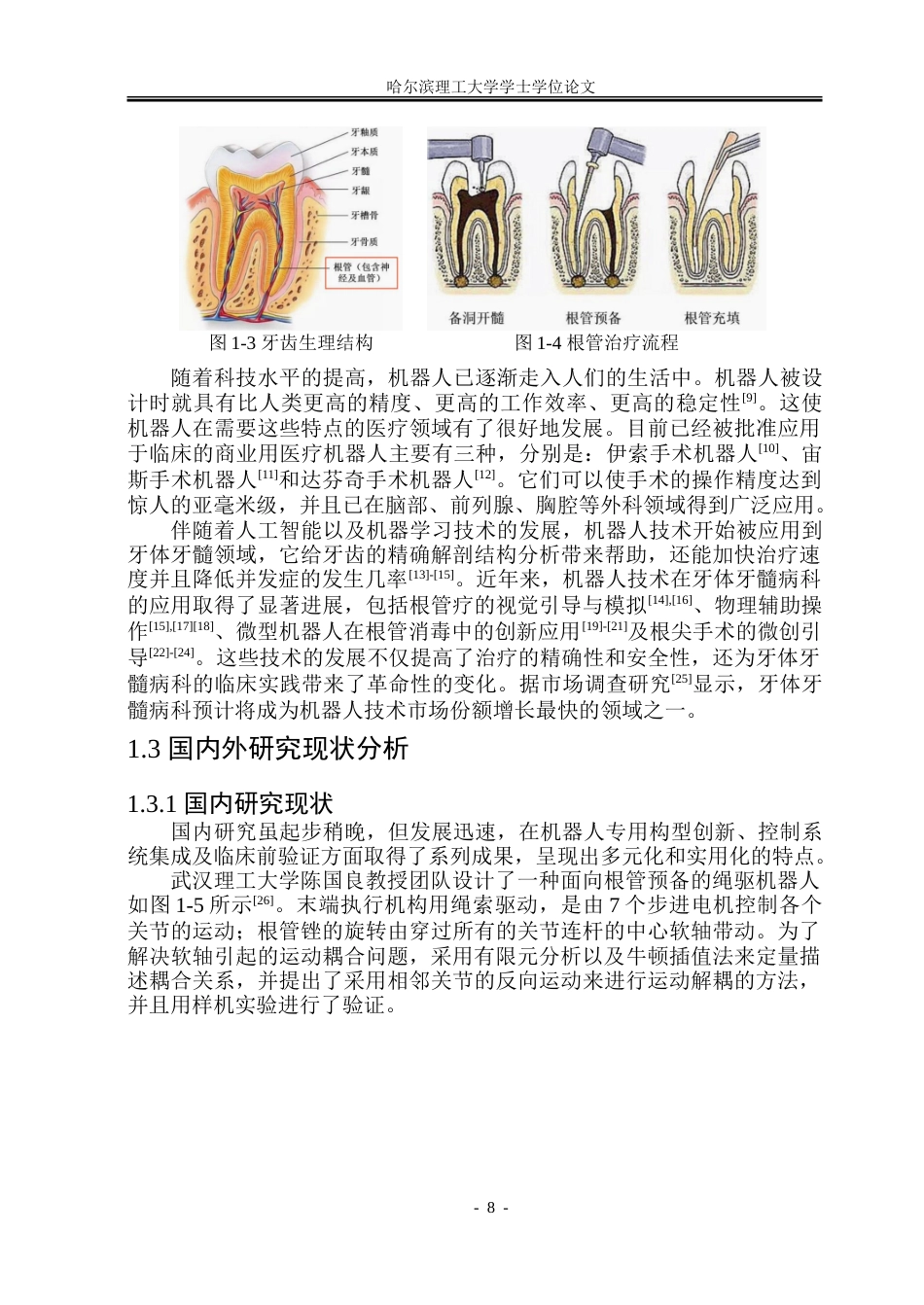 26年WP机械电子工程 根管诊疗机器人结构设计10.89-AI0.96-约59743字符.doc_第8页