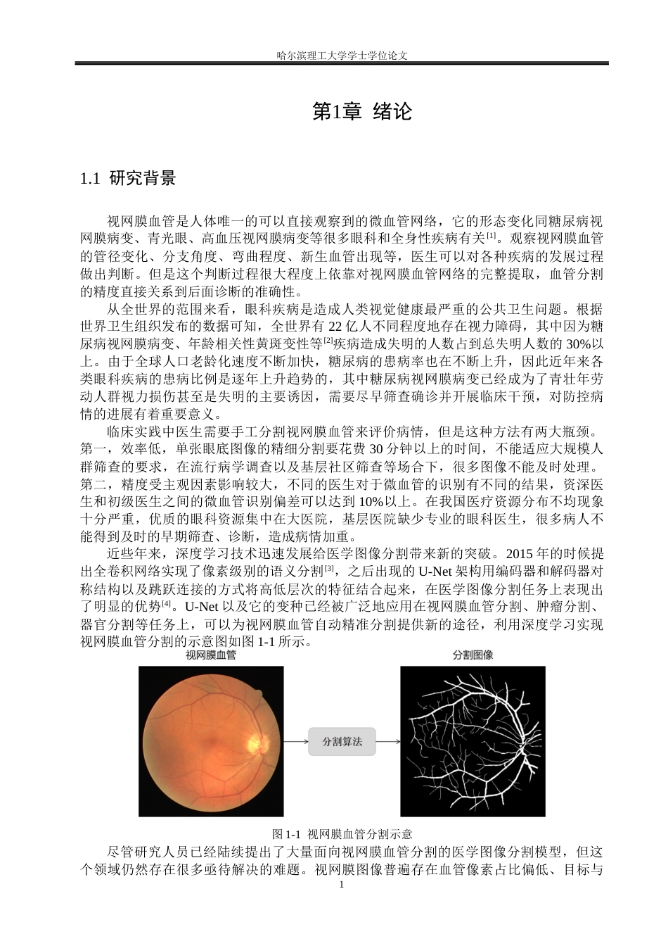 26年WP测控技术与仪器 基于改进U-Net的视网膜图像分割方法研究16.85-AI3.06(37060字).docx_第5页