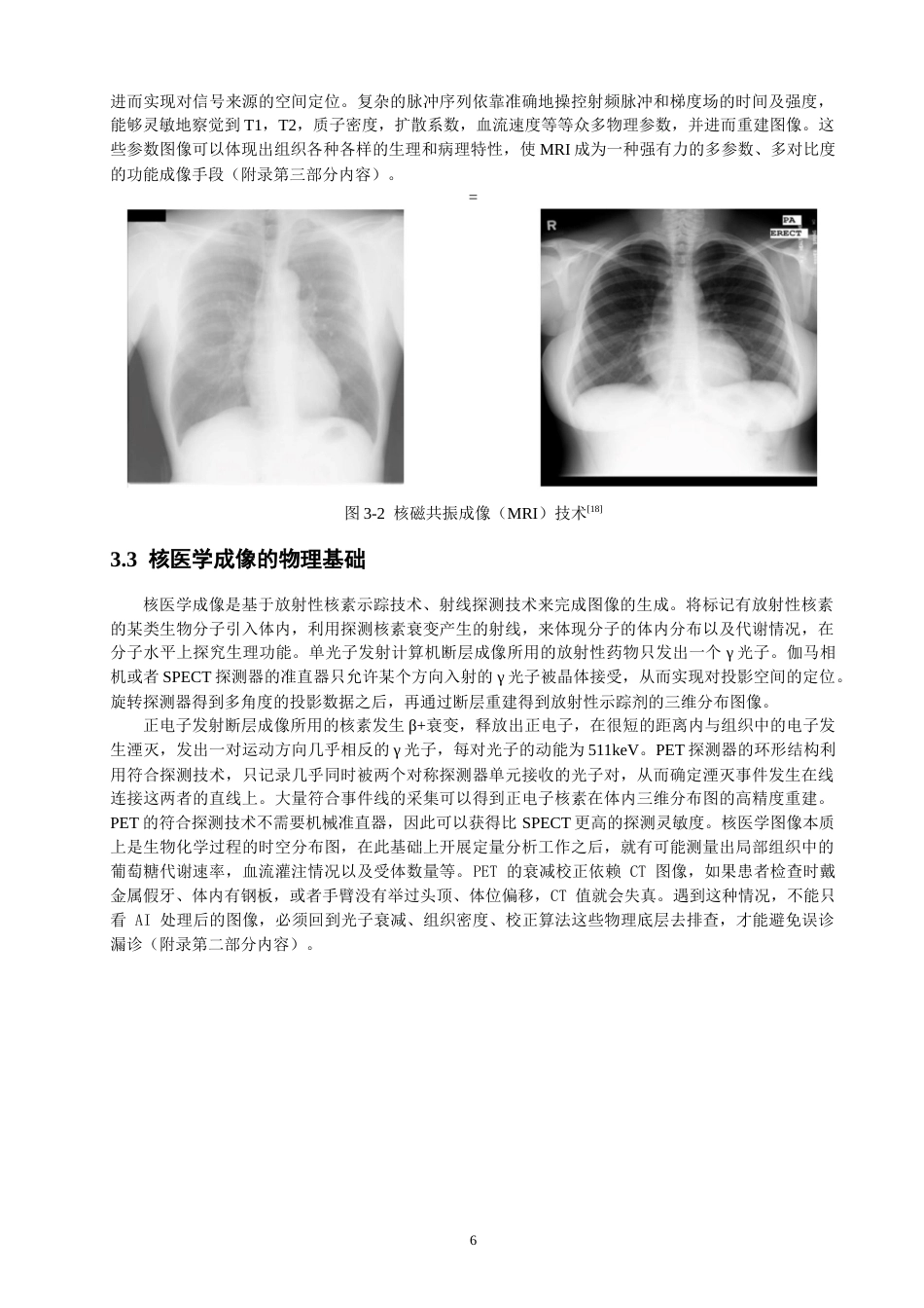 26年CH物理学 物理学原理在现代医学影像技术中的核心作用研究-终稿全(19622字).docx_第9页