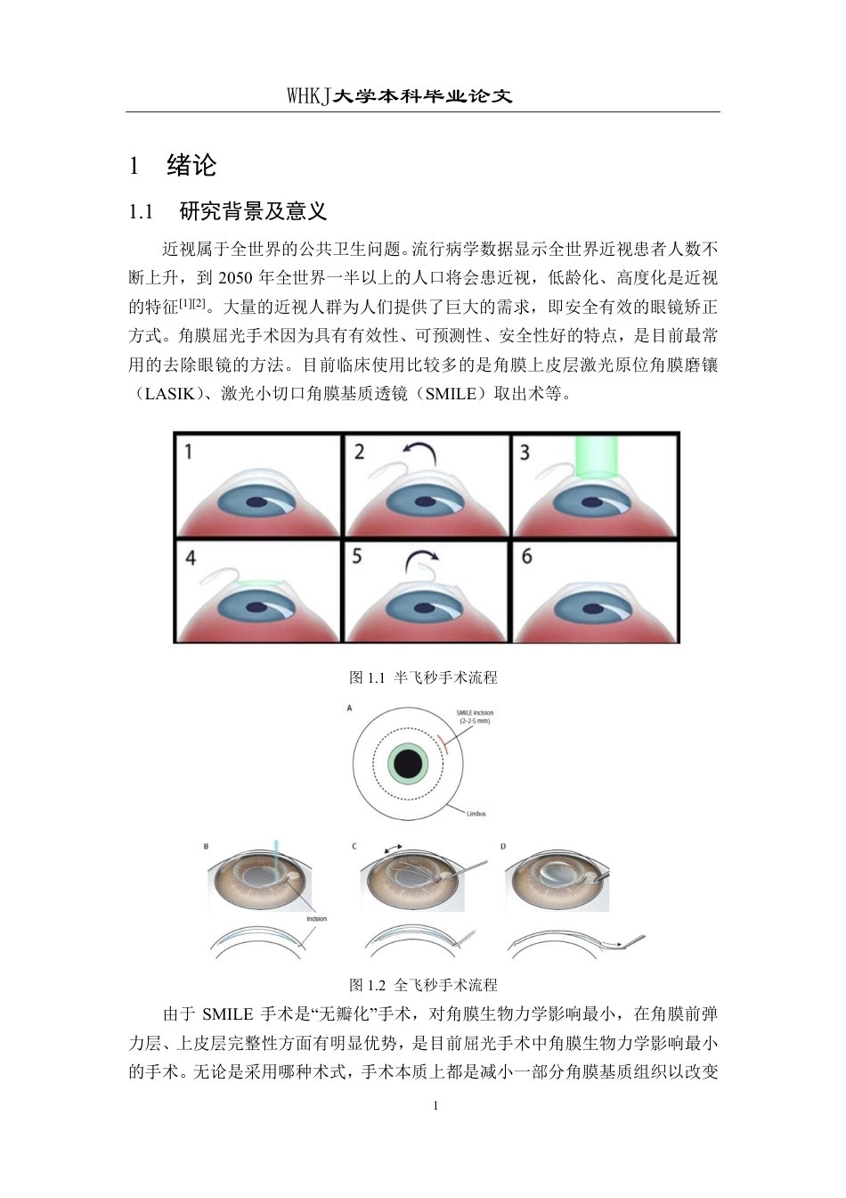 26年WP机械电子工程 近视手术后角膜扩张状态下眼内房水循环特性研究及其器官芯片模型研究9.21-AI6.58-约30440字符-全日制.pdf_第6页